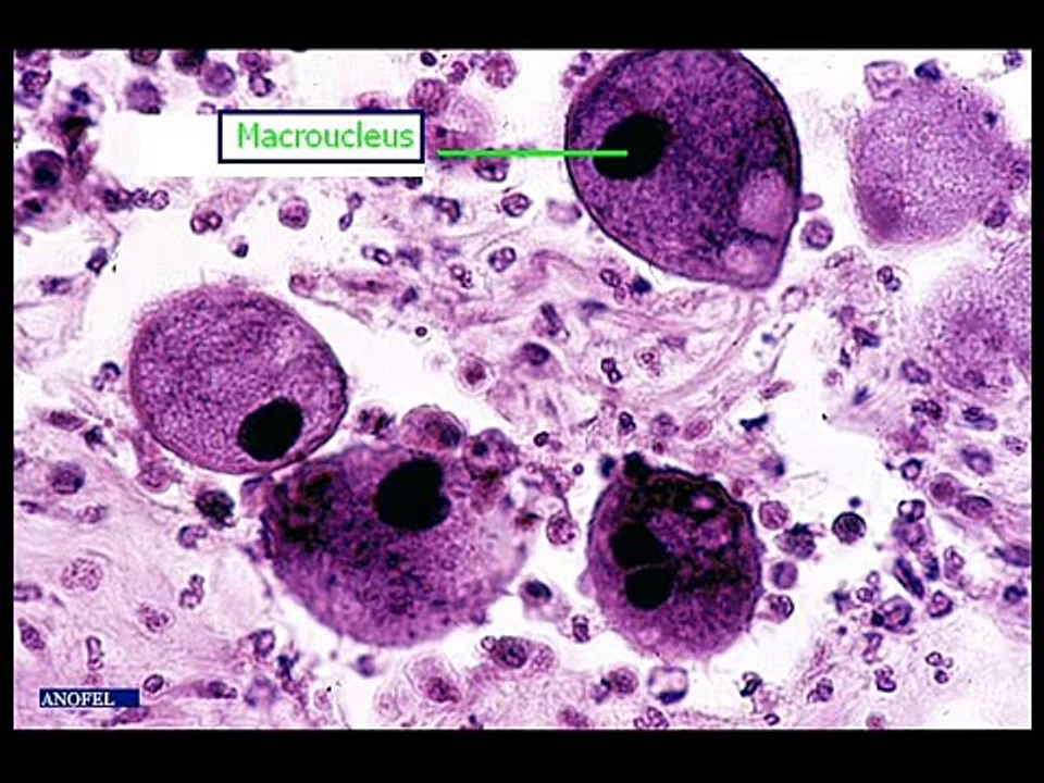 Revisions Tp parasitologie n°2