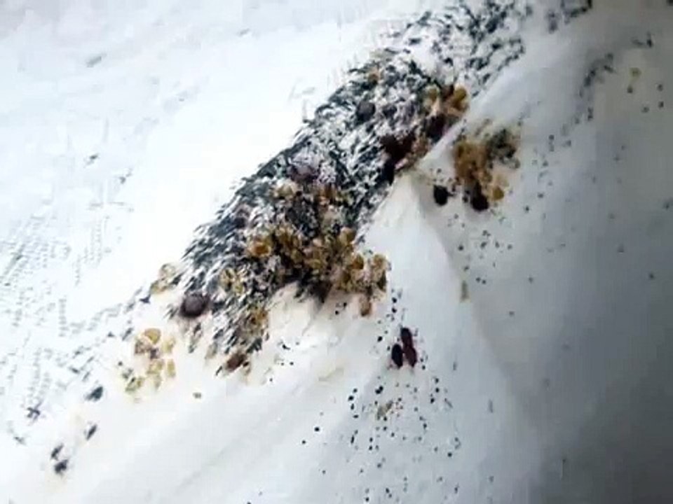 Disgusting BedBug Infestation