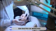 Adiós a las manchas en la piel