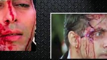Who BROKE Salman Khan's Nose_ _ Salman Khan Fights In Real Life