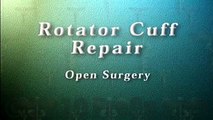 Rotator Cuff Repair Open Surgery