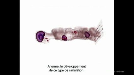 Exemples de simulation numérique, corps humain