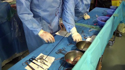 Imagerie interventionnelle CHU Toulouse 15 juin 2015