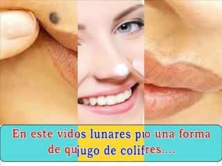 Como Quitar Lunares De Carne