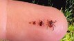 Ticks and Lyme Disease Prevention Tips