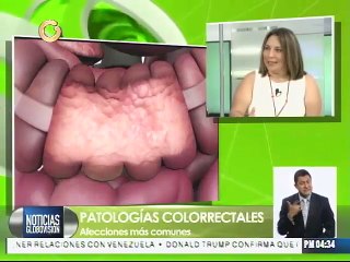 Conozca las enfermedades más comunes del ano, recto y colon