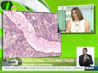 ¿Cómo prevenir enfermedades del ano, recto y colon?
