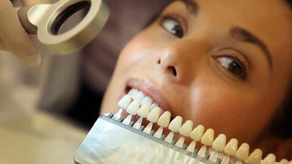 Indirect Composite Veneers Demonstration.