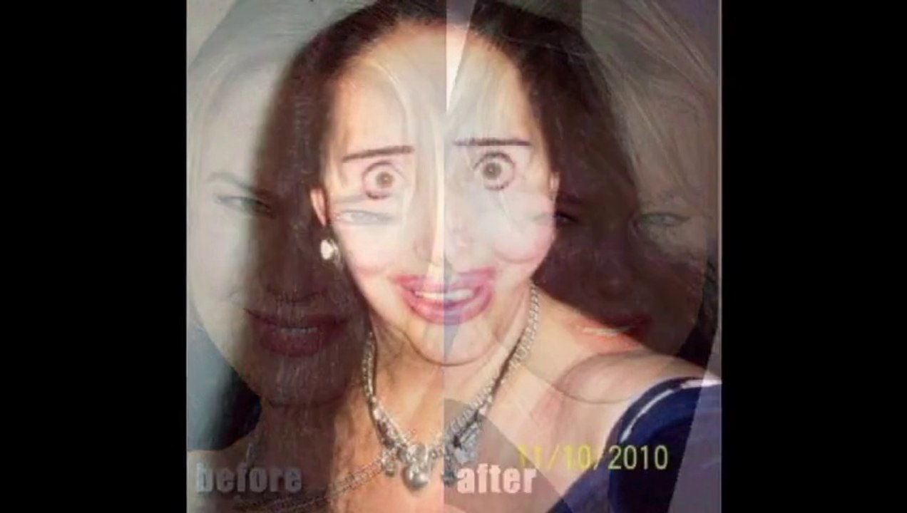 Kada plasticne operacije podju po zlu