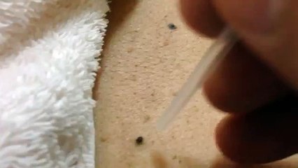 Çayyolu Royal Kombi Servisi 0312-279 15 16-