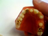 Couronne dentaire céramique, prothèses dentaires (www.les-dents.com).mov