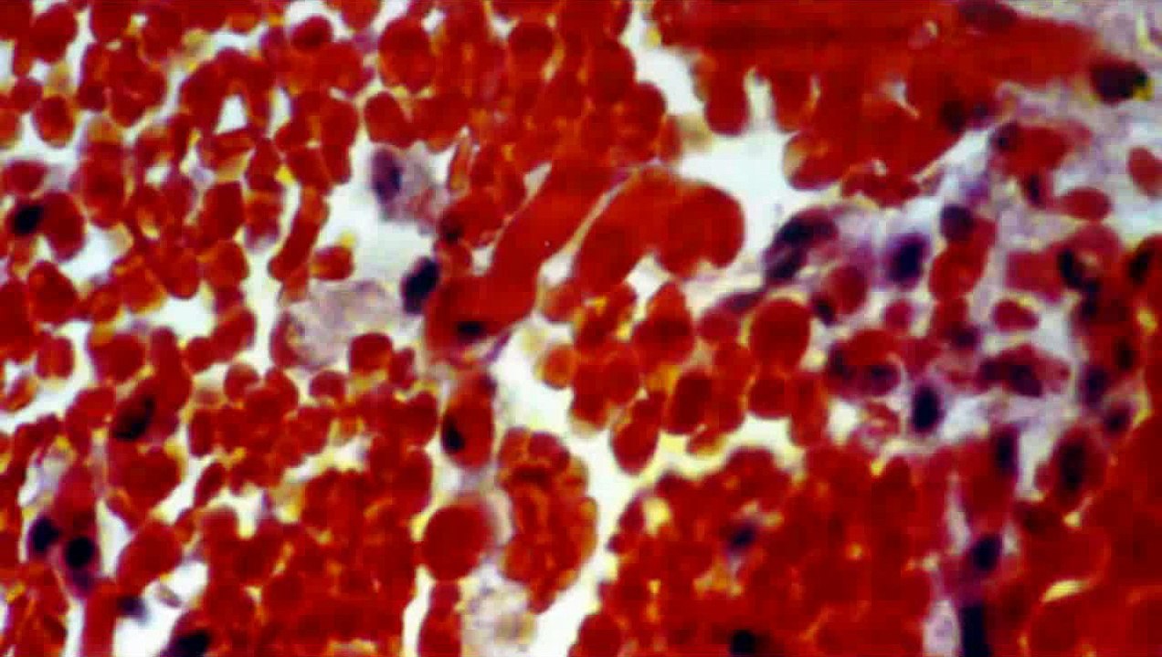 Google's Nanobots to Search Inside the Human Body!