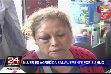 Mujer fue agredida salvajemente por su propio hijo