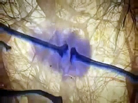 Density of Cannabinoid Receptors in the Brain & Human Body, Areas Where Cannabinoids Like THC Bind