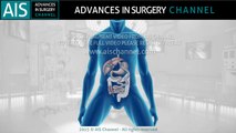Revisional bariatric surgery for internal hernia after a Roux-en-Y gastric bypass
