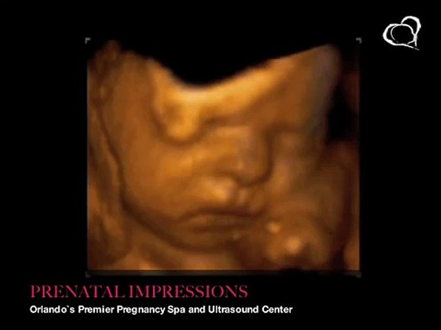 10++ 32 week 4d ultrasound image HD