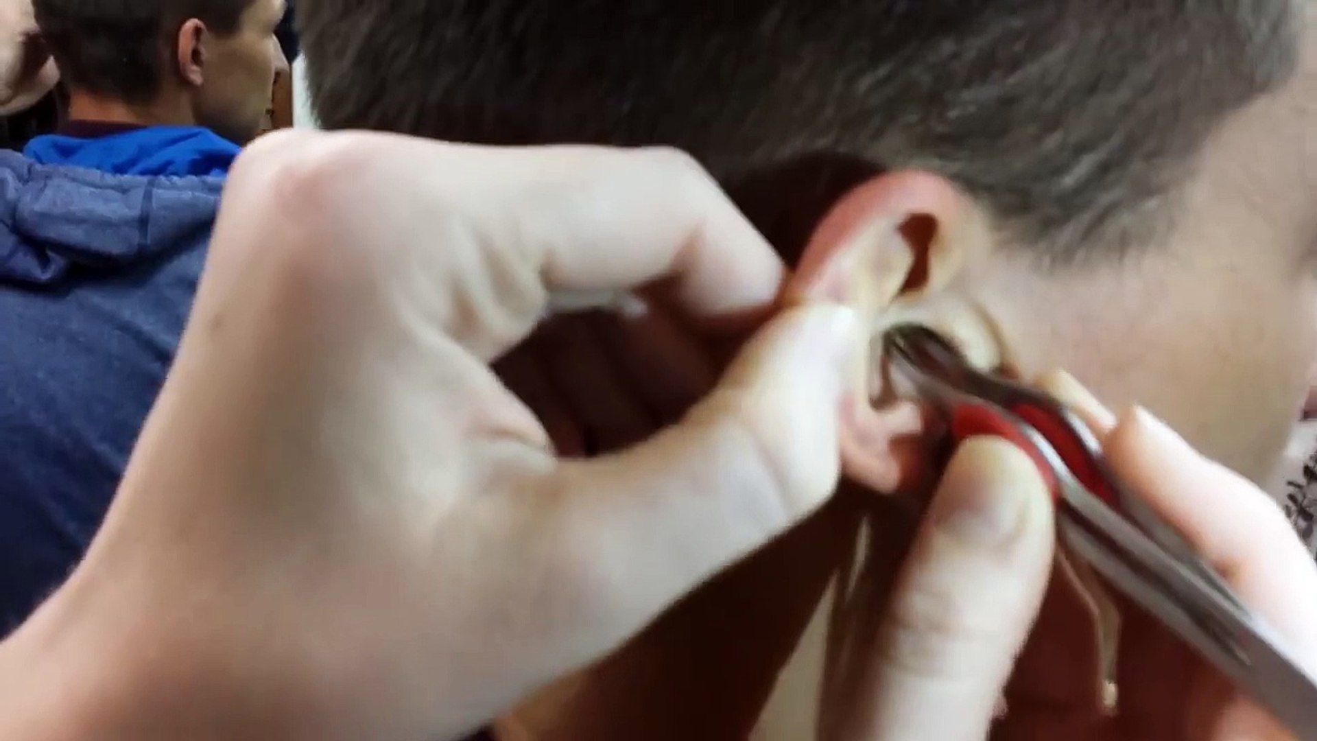 Un énorme bouchon de cérumen dans l'oreille - Vidéo Dailymotion