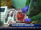 Human heart beats in a box