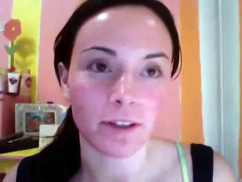Video Diary for CO2 Fractional Laser for acne scarring (Day 4 of Recovery)