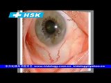 2009 Iridologia Software | East Iridology Hsk iriscope: HSK Camara para iridologia |Medicina Natural Holistica - Iridologia, Acupuntura, Florais, Cromoterapia