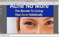 Acne No More Review A Real User's Acne No More Review (Product Preview Included Inside) -  Acne No More Discount