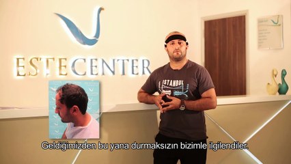 Saç Ektiren Hasta Yorumları - Hussein Osama