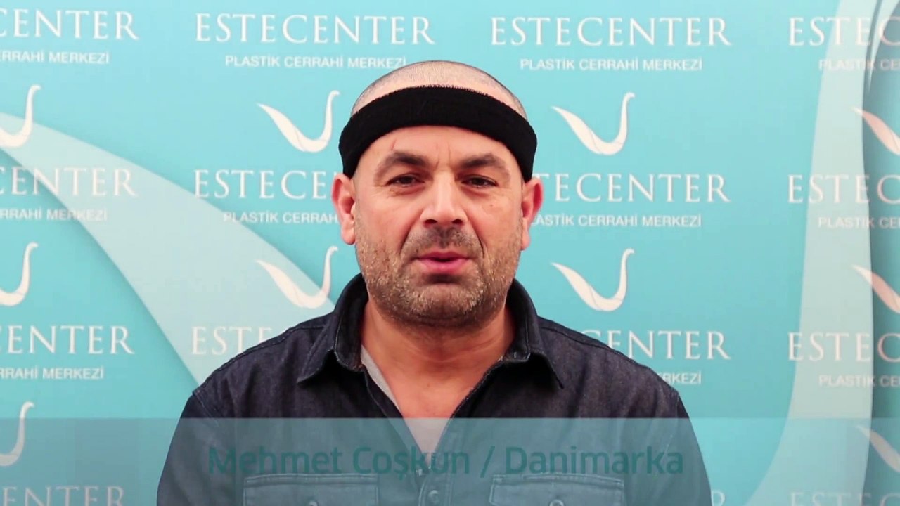 Saç Ektiren Hasta Yorumları - Mehmet Coşkun (Yeni)