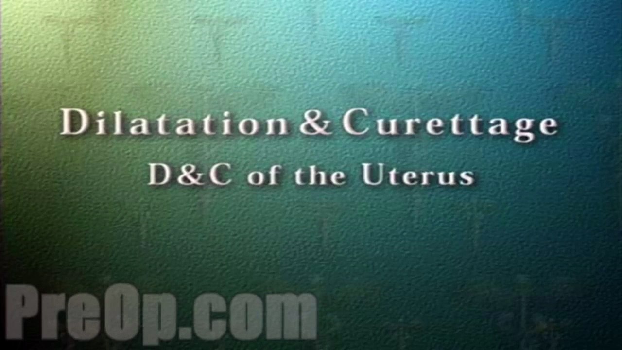 Dilation and Curettage D & C Surgery PreOp® Patient Engagement and Education