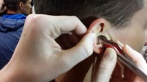 Removing ear wax - Gross