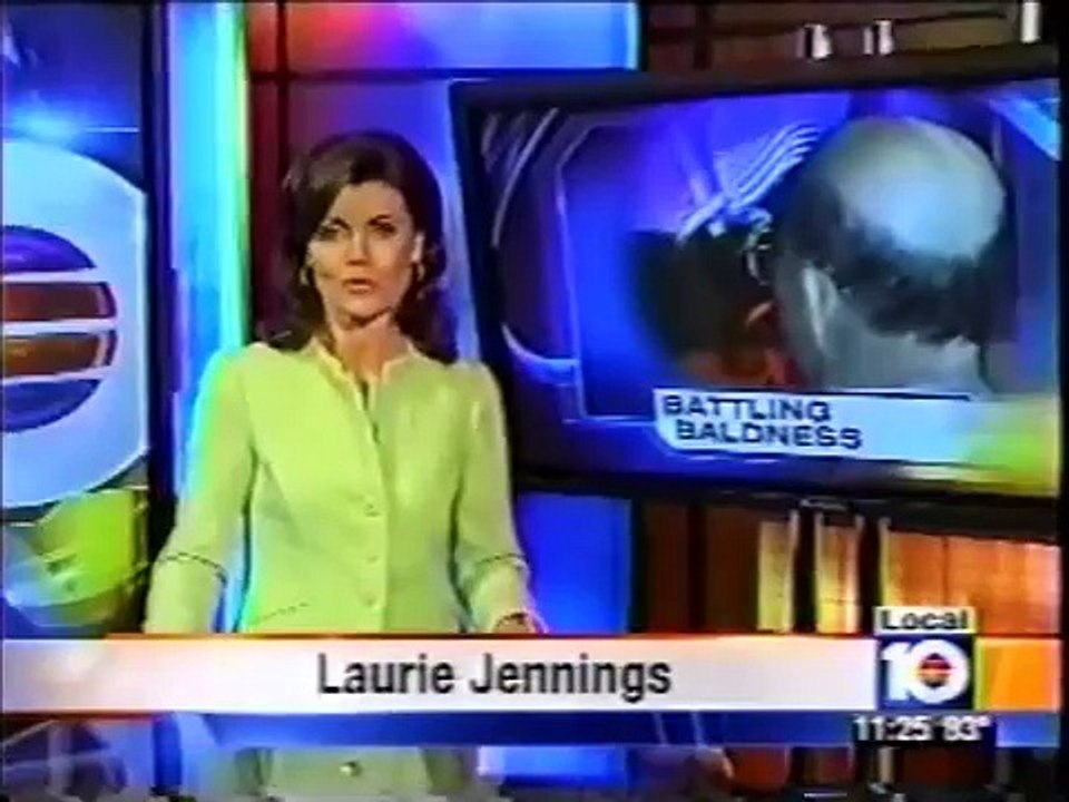 WPLG - Latisse for Male Pattern Hair Loss