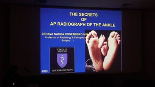 The Secrets of AP radiograph of the Ankle - Zehava Sadka Rosenberg