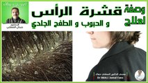 وصفة لعلاج قشرة الرأس حبوب و الطفح الجلدي / Dandruff - د. جمال الصقلي