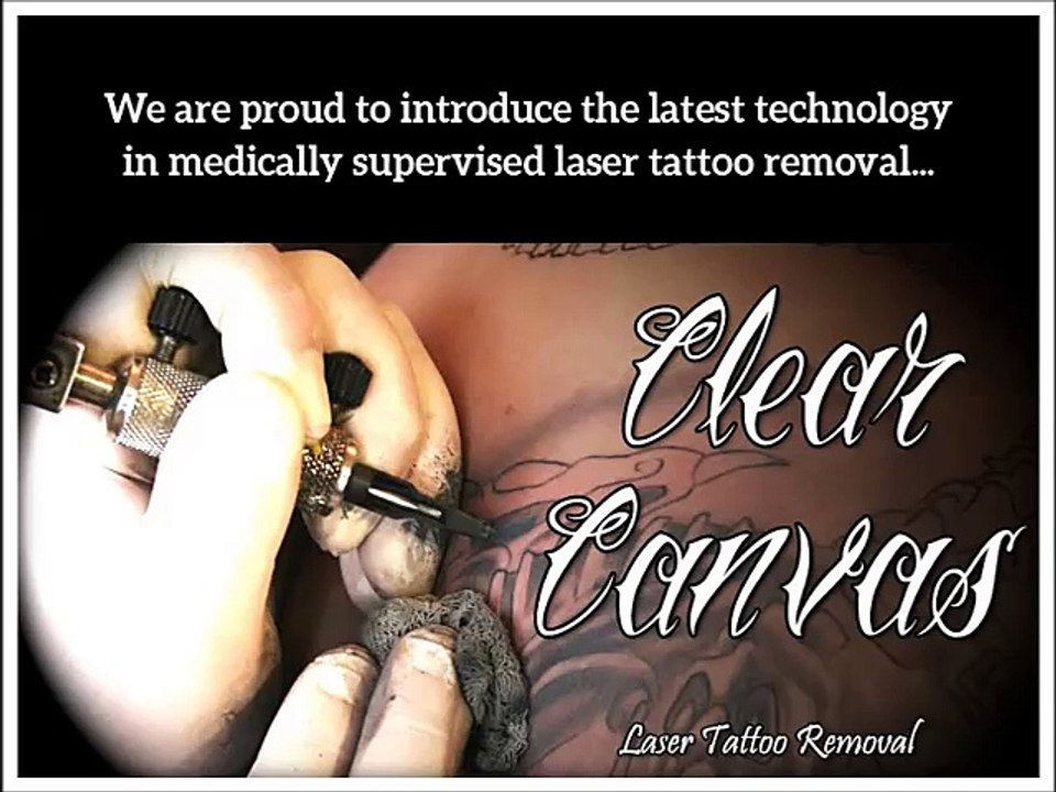 Medically Supervised Laser Tattoo Removal in Northwest Arkansas