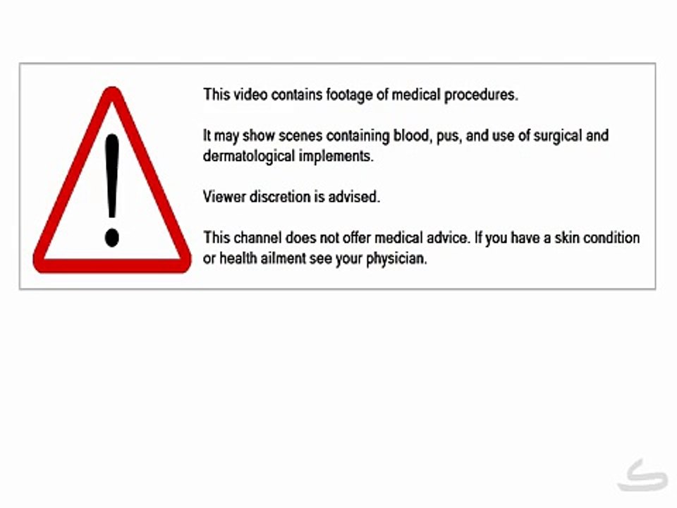 KEÇİÖREN İMMERGASS KOMBİ SERV.0312-279-15-16