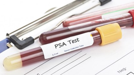 Cancer de la prostate : des facteurs de risque au dépistage