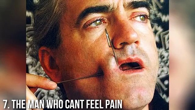 10 Amazing People With Real Superpowers