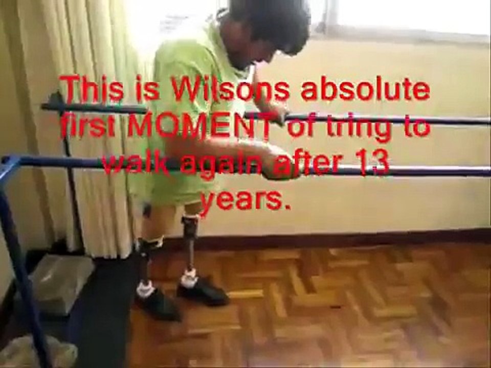 Double Amputee on LIMBS Knees in La Paz, Bolivia