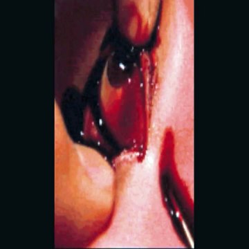 omg keep watching so disturbing