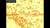 All About Escherichia Coli & Escherichia Coli Infection (E. Coli)