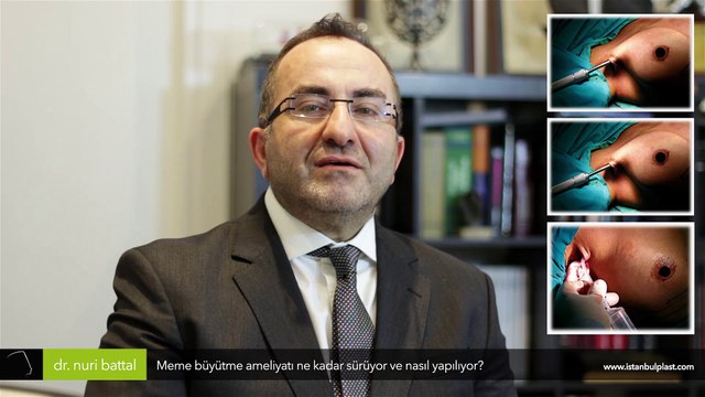 İzsiz göğüs büyütme ameliyatı ne kadar sürüyor ve nasıl yapılıyor? - Op. Dr. Nuri Battal