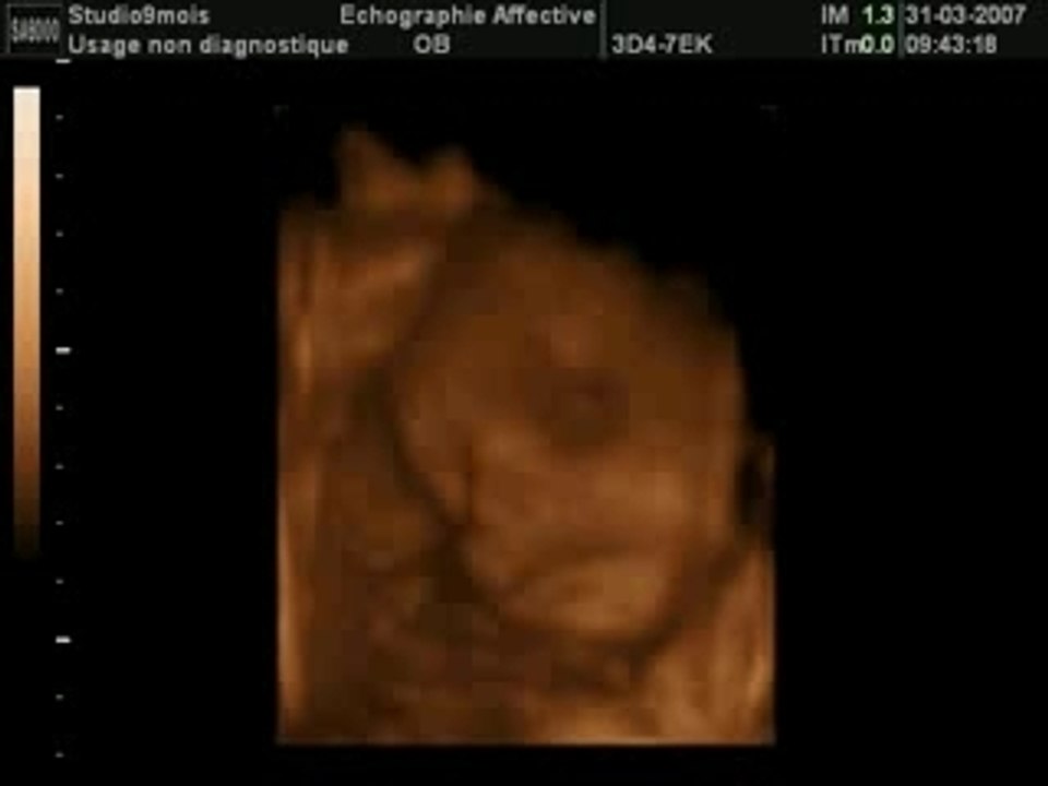 BEBE2_26_LIVE