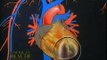 Reverse Heart Disease Naturally Nitric Oxide / L Arginine