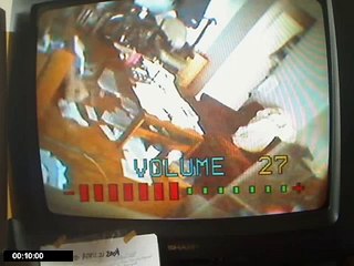 Seizures, Convulsions, Dystonia, April 21, 2004