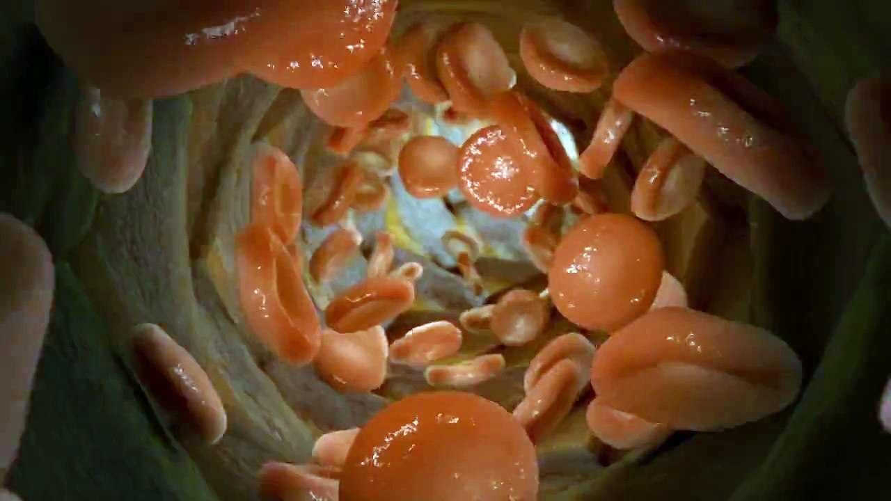 3D Medical Animation : Medical Explainer Video Production