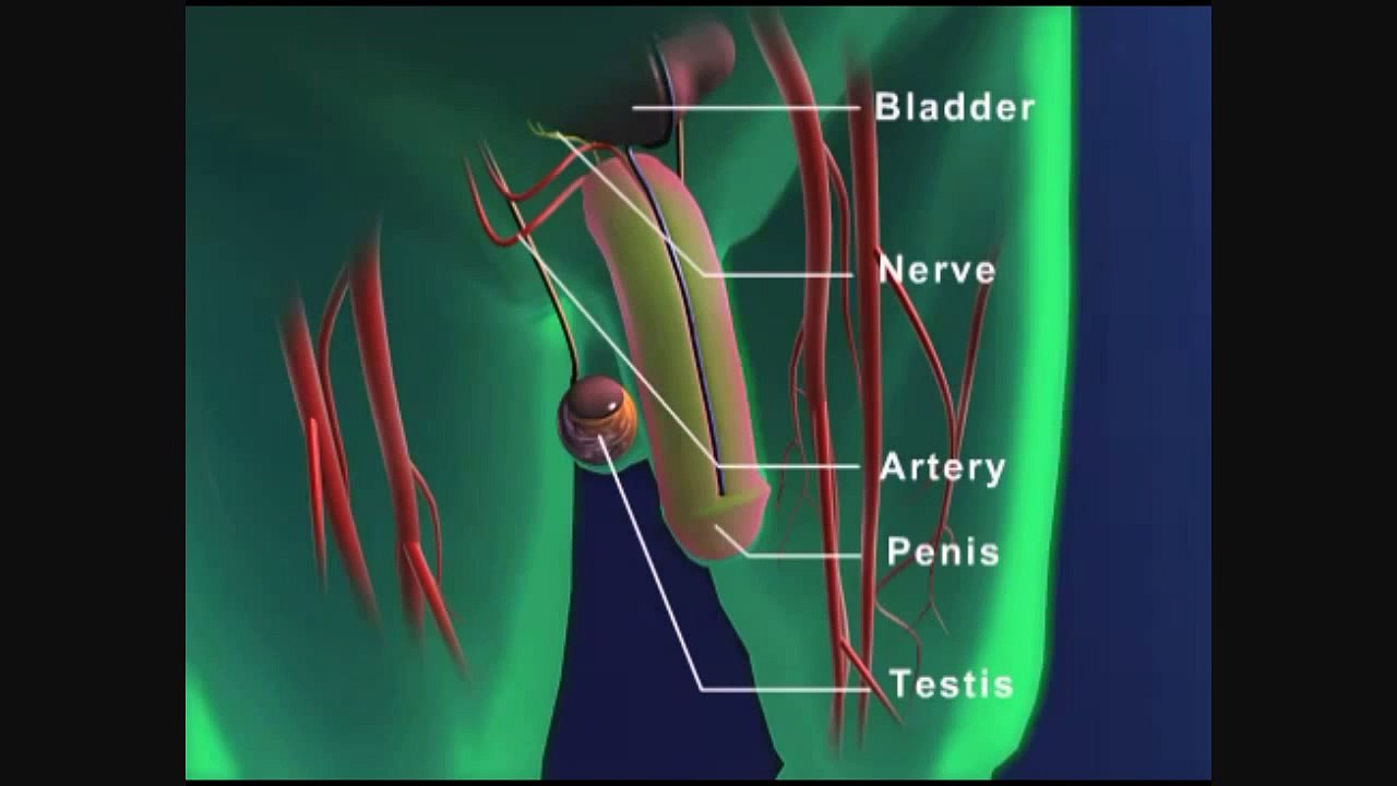 What is Erectile Dysfunction? by Urologist in Tampa