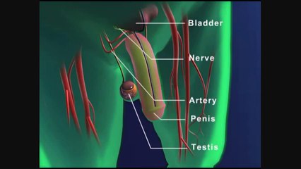 What is Erectile Dysfunction? by Urologist in Tampa