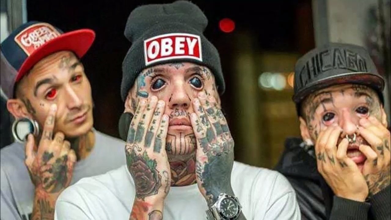 【閲覧注意】グロ注意 失明のリスクと引き換えに得た神秘的な瞳