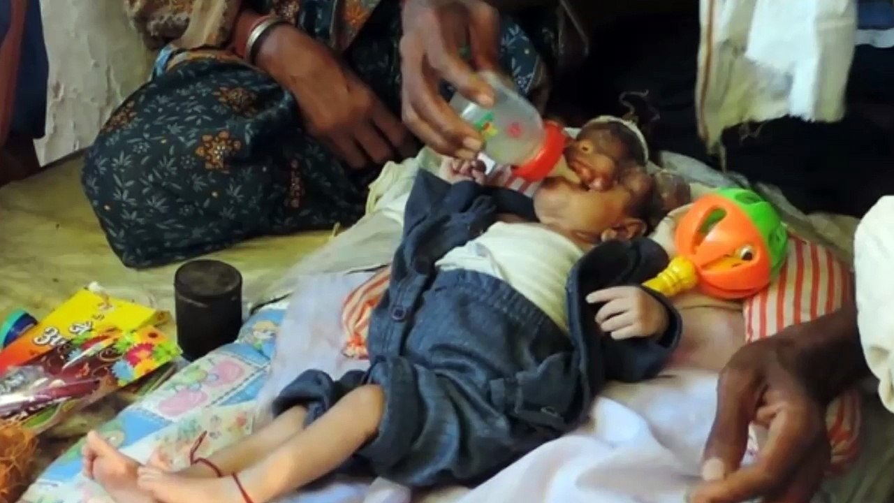 【閲覧注意】こんな姿で生まれた女の子はどんな人生を送ればいいのか