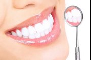 Sbiancamento denti ecco i consigli più efficaci