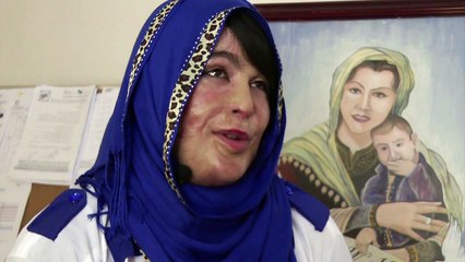Death threats stalk Afghan acid victim